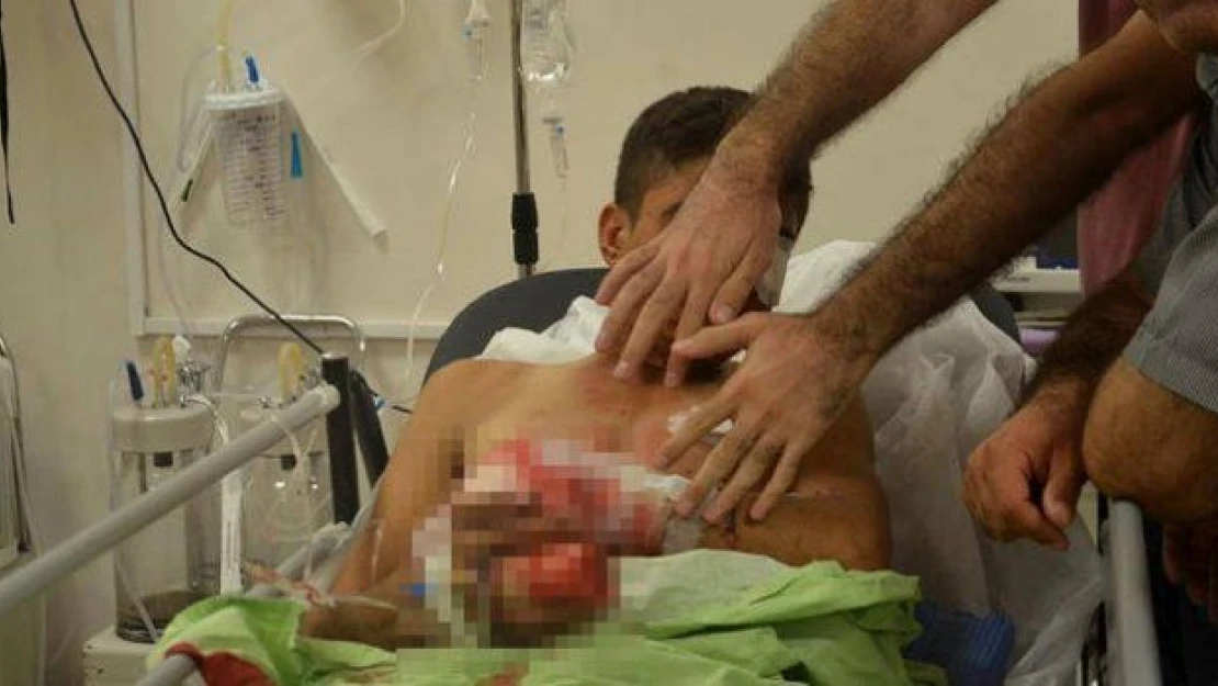 Teröristin hazırladığı bomba elinde patladı