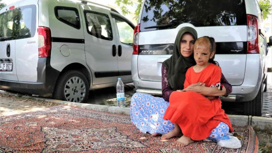 Yangında yüzü yanan Dilara'nın annesi: 'Allah razı olsun Sağlık Bakanlığından, kızımın ameliyatını karşılıyor'