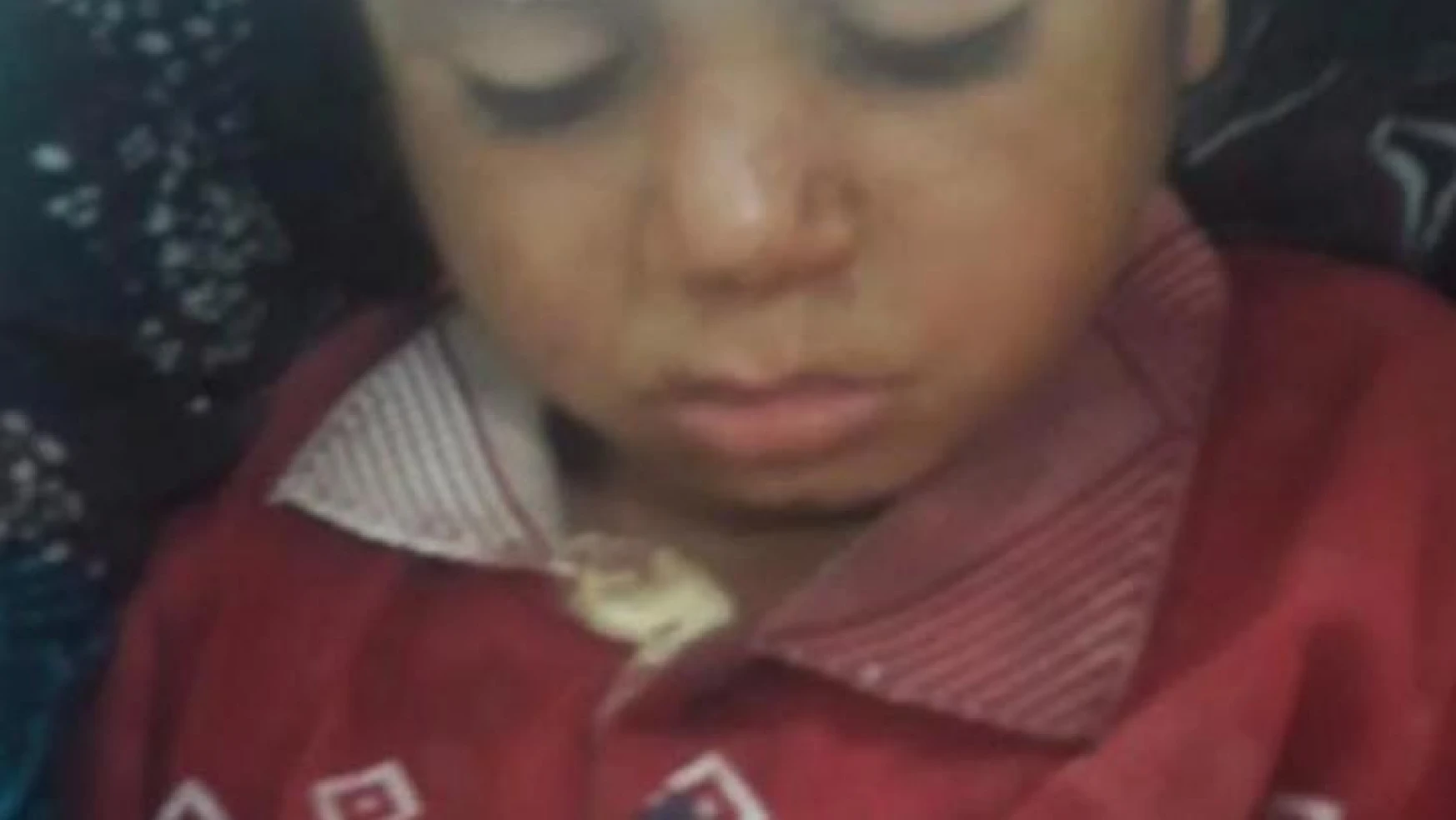 Şanlıurfa'da atın teptiği çocuk yaralandı