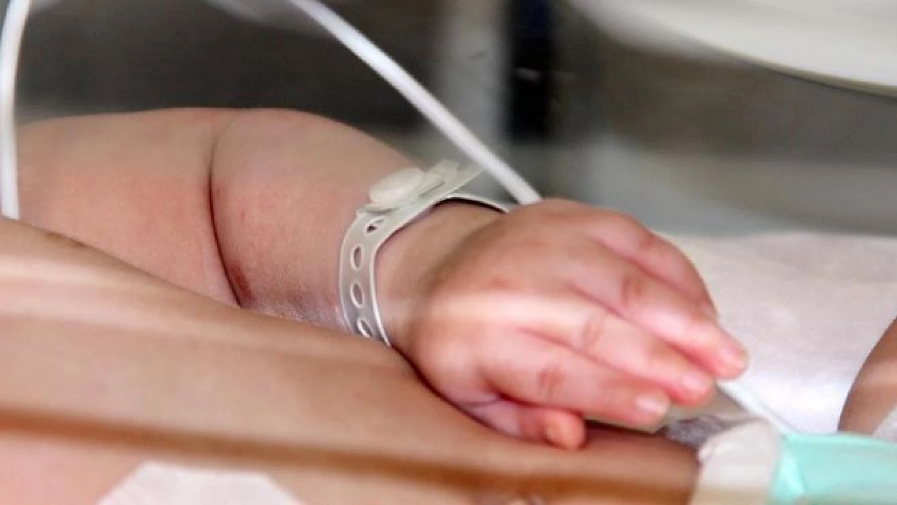 'Yılda 12 bin bebek kalp hastası olarak doğuyor'