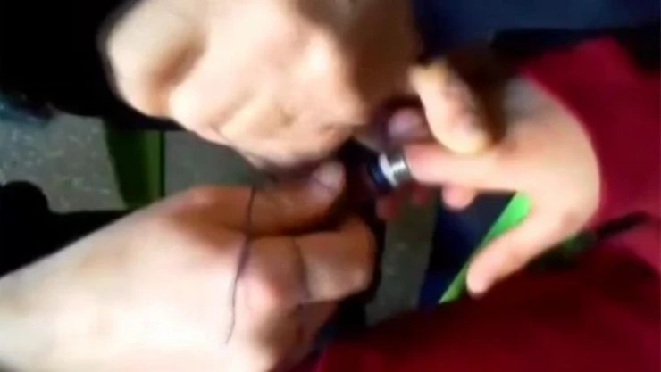 Parmağa sıkışan yüzüğü itfaiye ekipleri 'ip sarma' tekniğiyle çıkardı