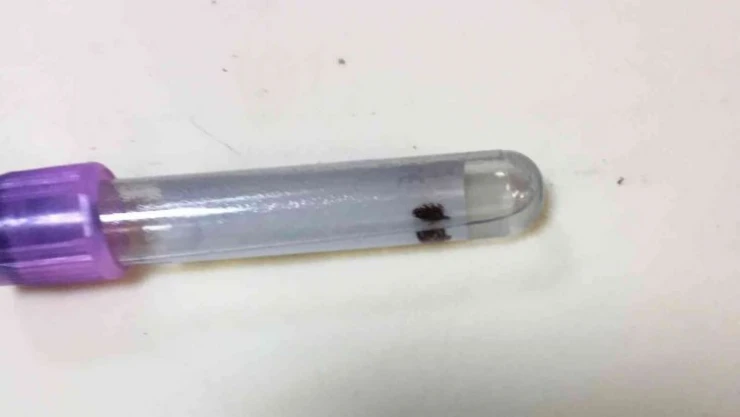 Vücuduna yapışan kene acil serviste çıkarıldı